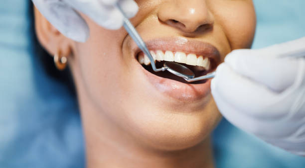 Best Emergency Dentist for Knocked-Out Tooth in Hayden, ID